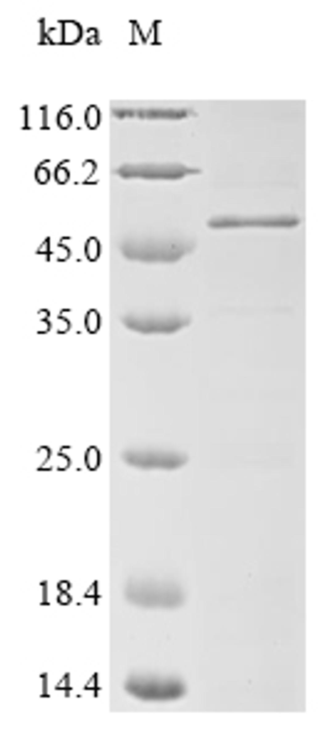 (Tris-Glycine gel) Discontinuous SDS-PAGE (reduced) with 5% enrichment gel and 15% separation gel.