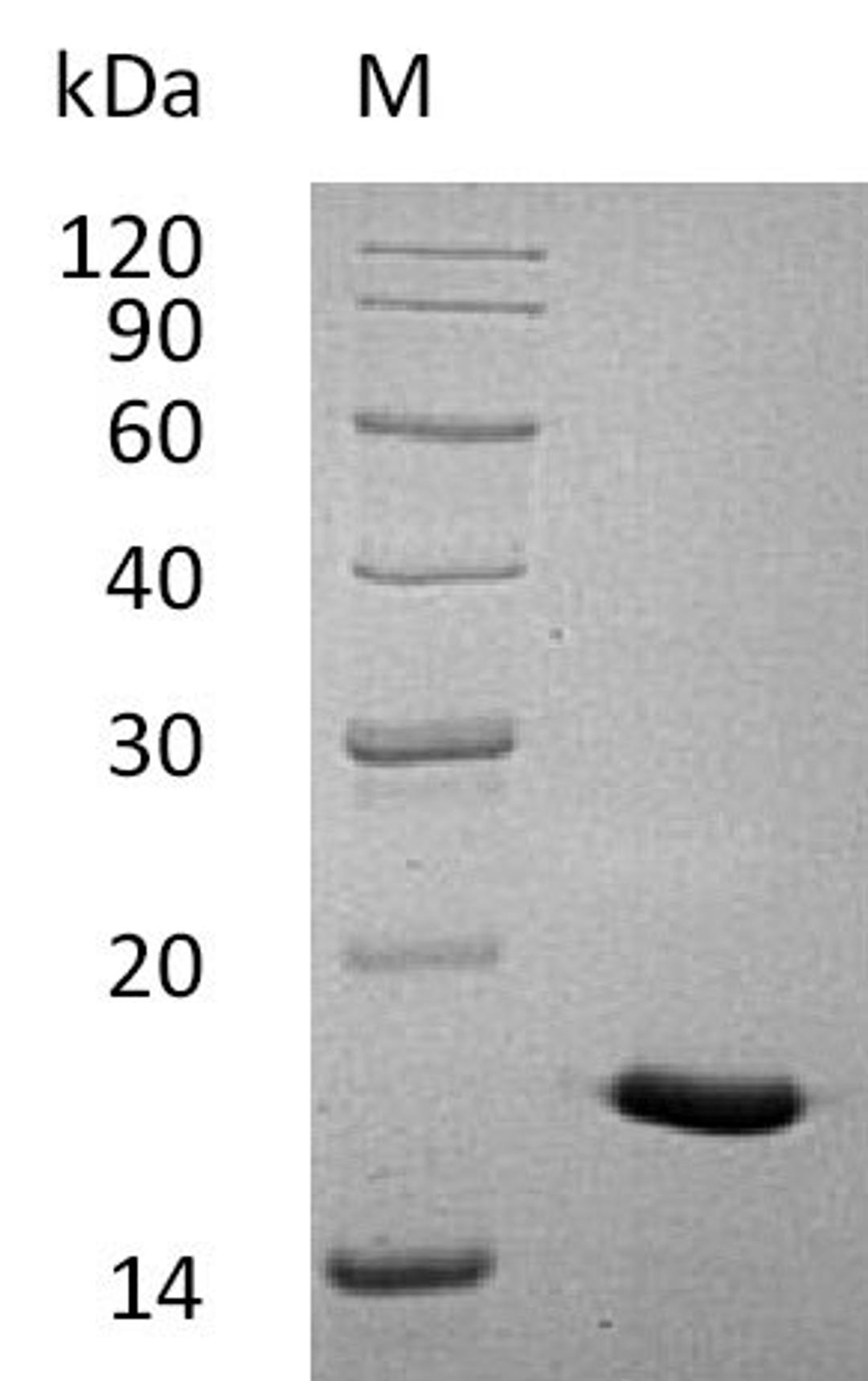 (Tris-Glycine gel) Discontinuous SDS-PAGE (reduced) with 5% enrichment gel and 15% separation gel.