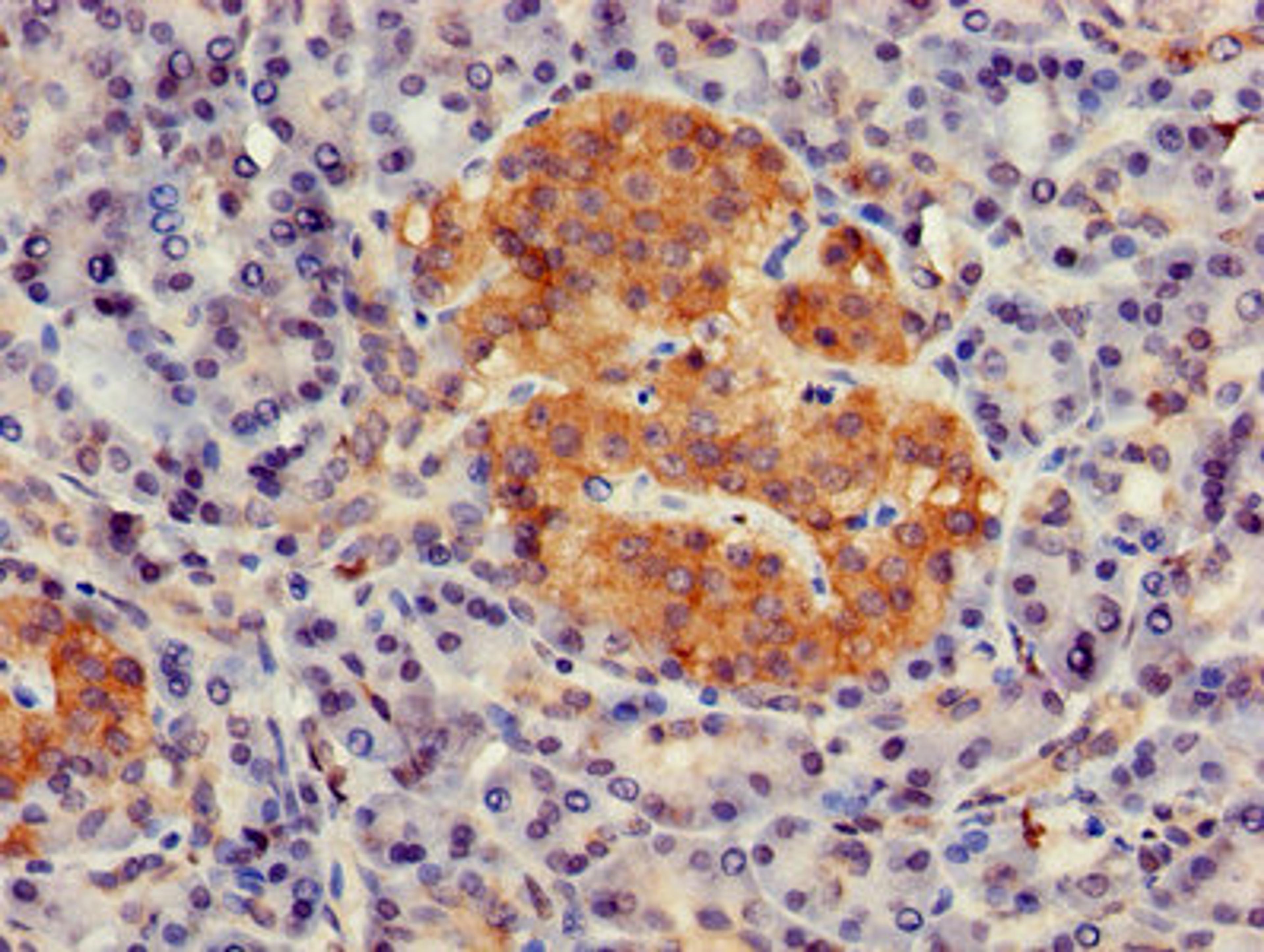 Immunohistochemistry of paraffin-embedded human pancreatic tissue using CSB-PA009616LA01HU at dilution of 1:100
