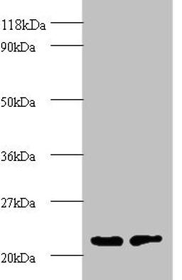 Western blot. All lanes: proteasome subunit beta type-2 antibody at 2ug/ml. Lane 1: EC109 whole cell lysate. Lane 2: 293T whole cell lysate. Secondary. Goat polyclonal to rabbit IgG at 1/15000 dilution. Predicted band size: 23 kDa. Observed band size: 23 kDa. 