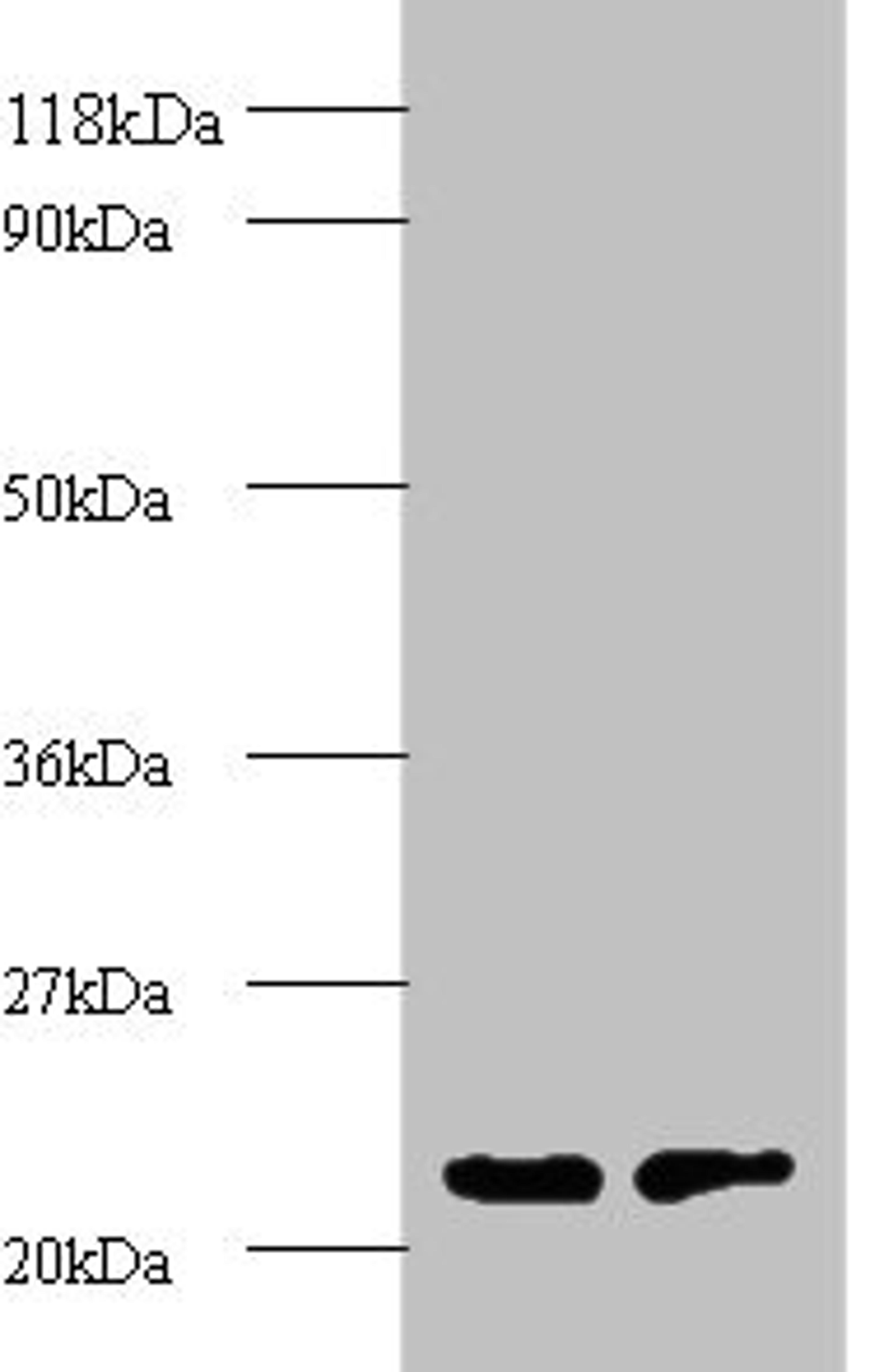 Western blot. All lanes: proteasome subunit beta type-2 antibody at 2ug/ml. Lane 1: EC109 whole cell lysate. Lane 2: 293T whole cell lysate. Secondary. Goat polyclonal to rabbit IgG at 1/15000 dilution. Predicted band size: 23 kDa. Observed band size: 23 kDa. 