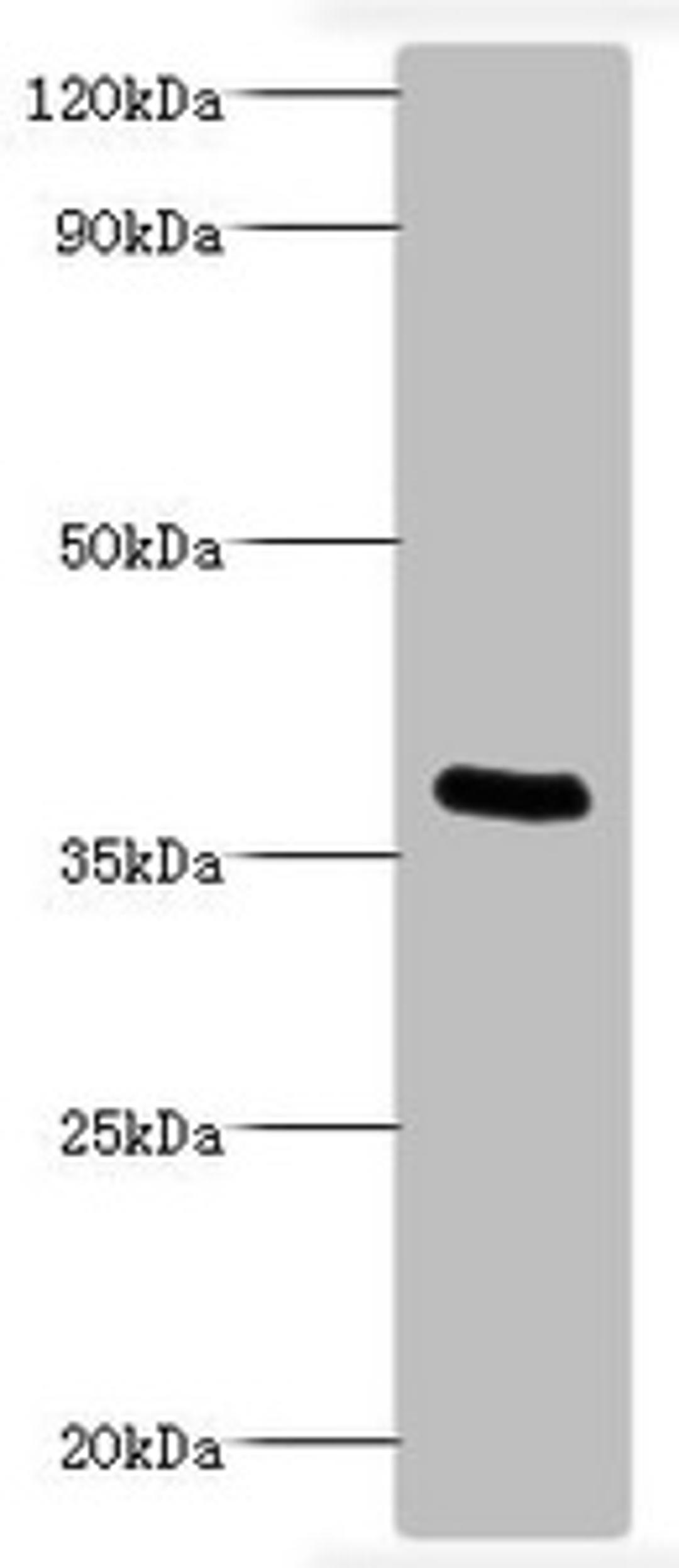 Western blot. All lanes: Bordella pertussis pertussis toxin subunit 1 antibody at 2ug/ml + recombinant Bordella pertussis pertussis toxin subunit 1 100ng. Secondary. Goat polyclonal to rabbit IgG at 1/1000 dilution. Predicted band size: 36 kDa. Observed band size: 36 kDa. 