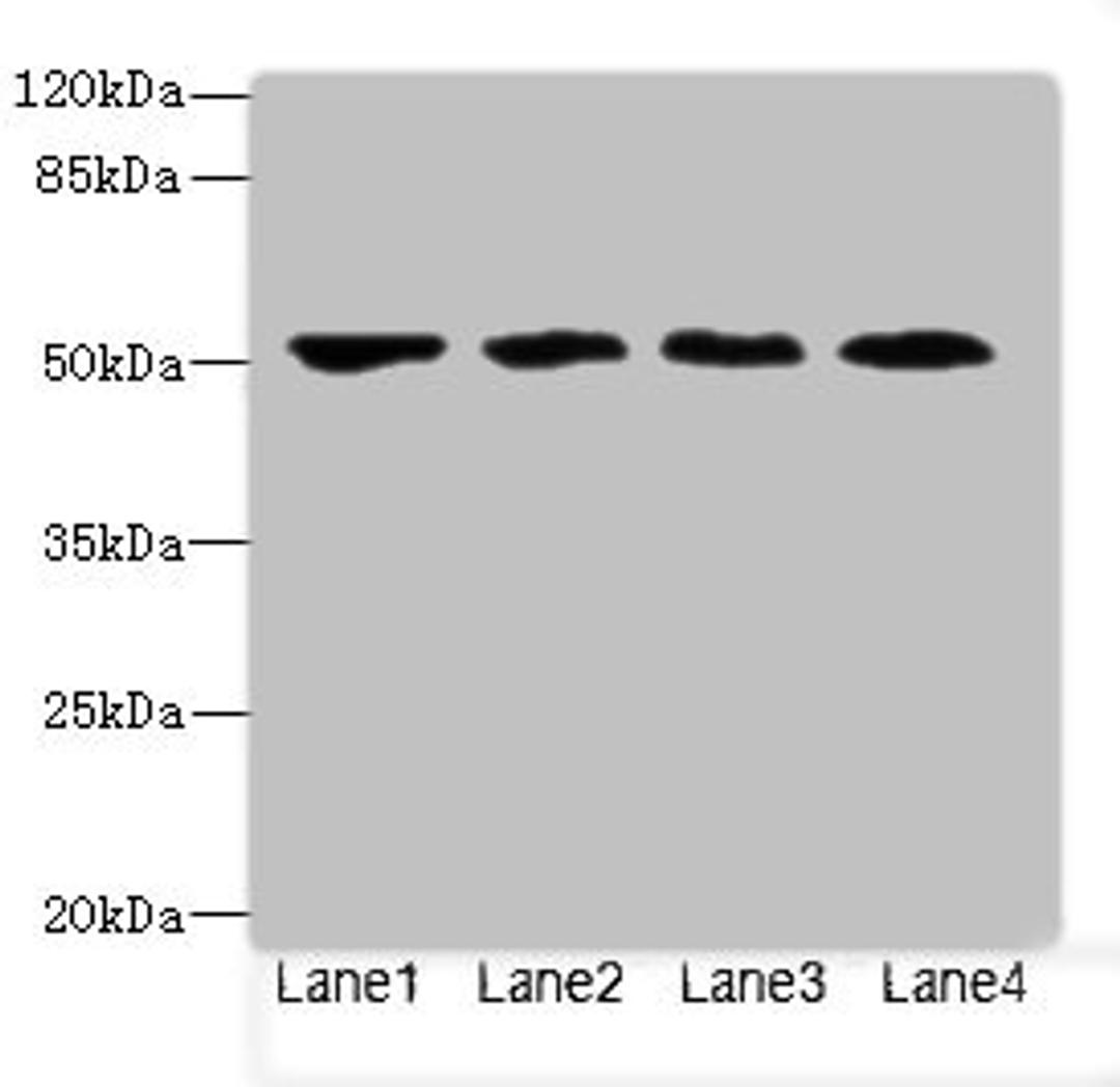 Western blot. All lanes: LRRC42 antibody at 10ug/ml. Lane 1: MCF-7 whole cell lysate. Lane 2: A549 whole cell lysate. Lane 3: HCT116 whole cell lysate. Lane 4: Colo320 whole cell lysate. Secondary. Goat polyclonal to rabbit IgG at 1/10000 dilution. Predicted band size: 49 kDa. Observed band size: 49 kDa. 