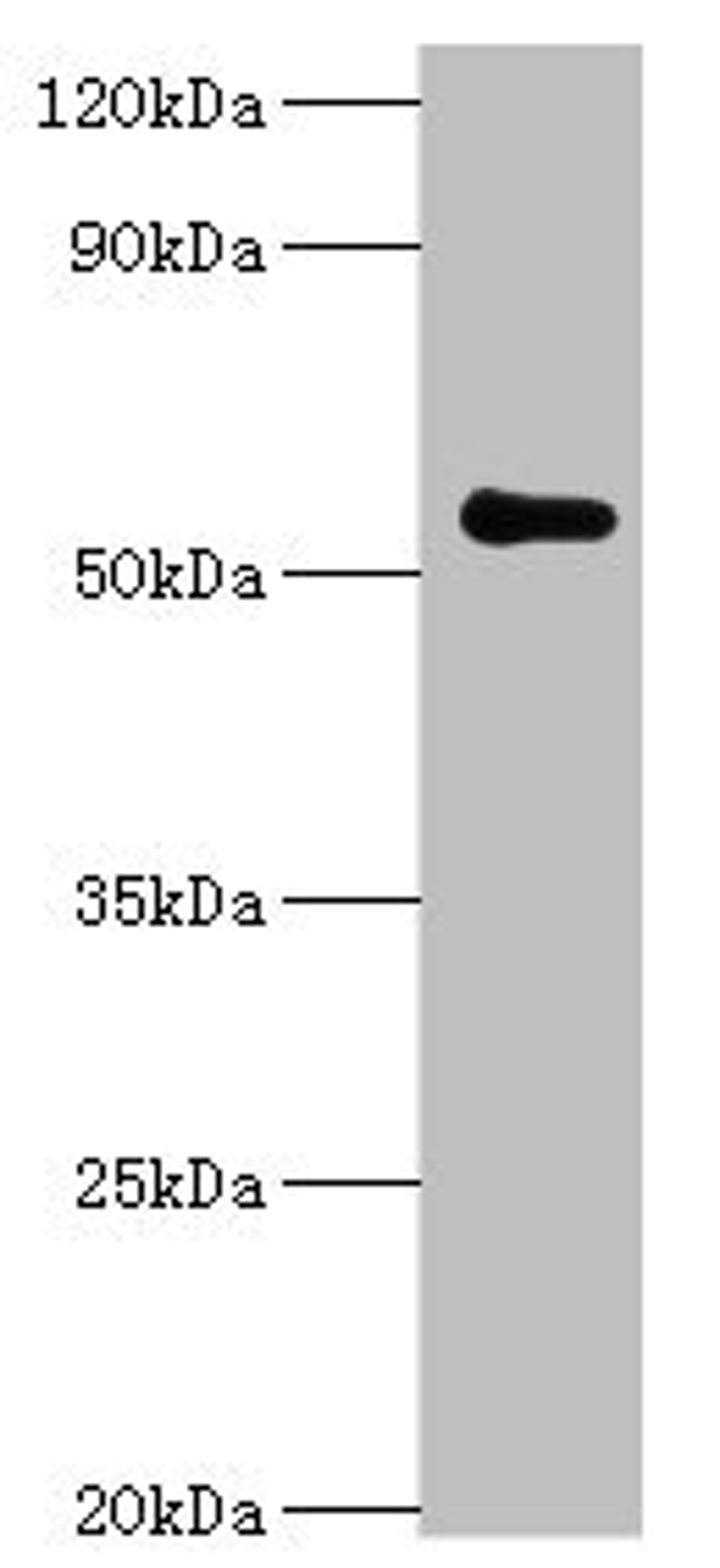 Western blot. All lanes: Poly [ADP-ribose] polymerase 3 antibody at 7ug/ml + Mouse kidney tissue. Secondary. Goat polyclonal to rabbit IgG at 1/10000 dilution. Predicted band size: 60 kDa. Observed band size: 60 kDa. 