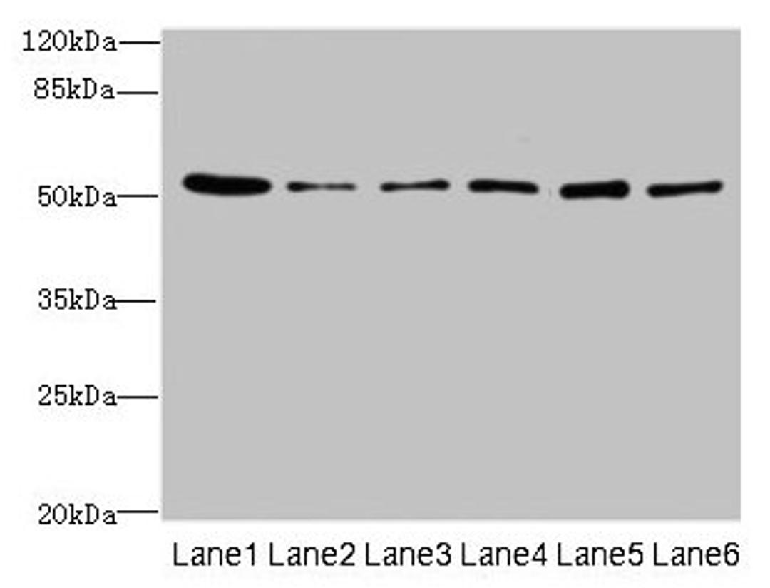 Western blot. All lanes: ZNF398 antibody at 3µg/ml. Lane 1: 293T whole cell lysate. Lane 2: Hela whole cell lysate. Lane 3: HepG2 whole cell lysate. Lane 4: Jurkat whole cell lysate. Lane 5: Caco-2 whole cell lysate. Lane 6: A549 whole cell lysate. Secondary. Goat polyclonal to rabbit IgG at 1/10000 dilution. Predicted band size: 72, 53 kDa. Observed band size: 53 kDa