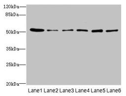 Western blot. All lanes: ZNF398 antibody at 3µg/ml. Lane 1: 293T whole cell lysate. Lane 2: Hela whole cell lysate. Lane 3: HepG2 whole cell lysate. Lane 4: Jurkat whole cell lysate. Lane 5: Caco-2 whole cell lysate. Lane 6: A549 whole cell lysate. Secondary. Goat polyclonal to rabbit IgG at 1/10000 dilution. Predicted band size: 72, 53 kDa. Observed band size: 53 kDa