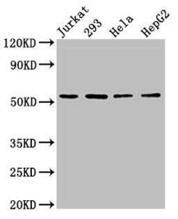 Western Blot. Positive WB detected in: Jurkat whole cell lysate, 293 whole cell lysate, Hela whole cell lysate, HepG2 whole cell lysate. All lanes: SLC16A12 antibody at 3µg/ml. Secondary. Goat polyclonal to rabbit IgG at 1/50000 dilution. Predicted band size: 54 kDa. Observed band size: 54 kDa