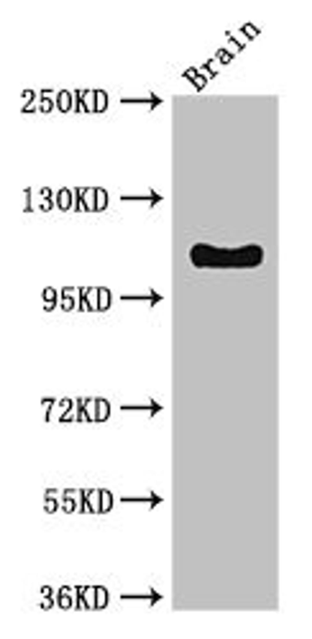 Western Blot. Positive WB detected in: Mouse brain tissue. All lanes: DSG3 antibody at 3ug/ml. Secondary. Goat polyclonal to rabbit IgG at 1/50000 dilution. predicted band size: 108 kDa. observed band size: 108 kDa. 