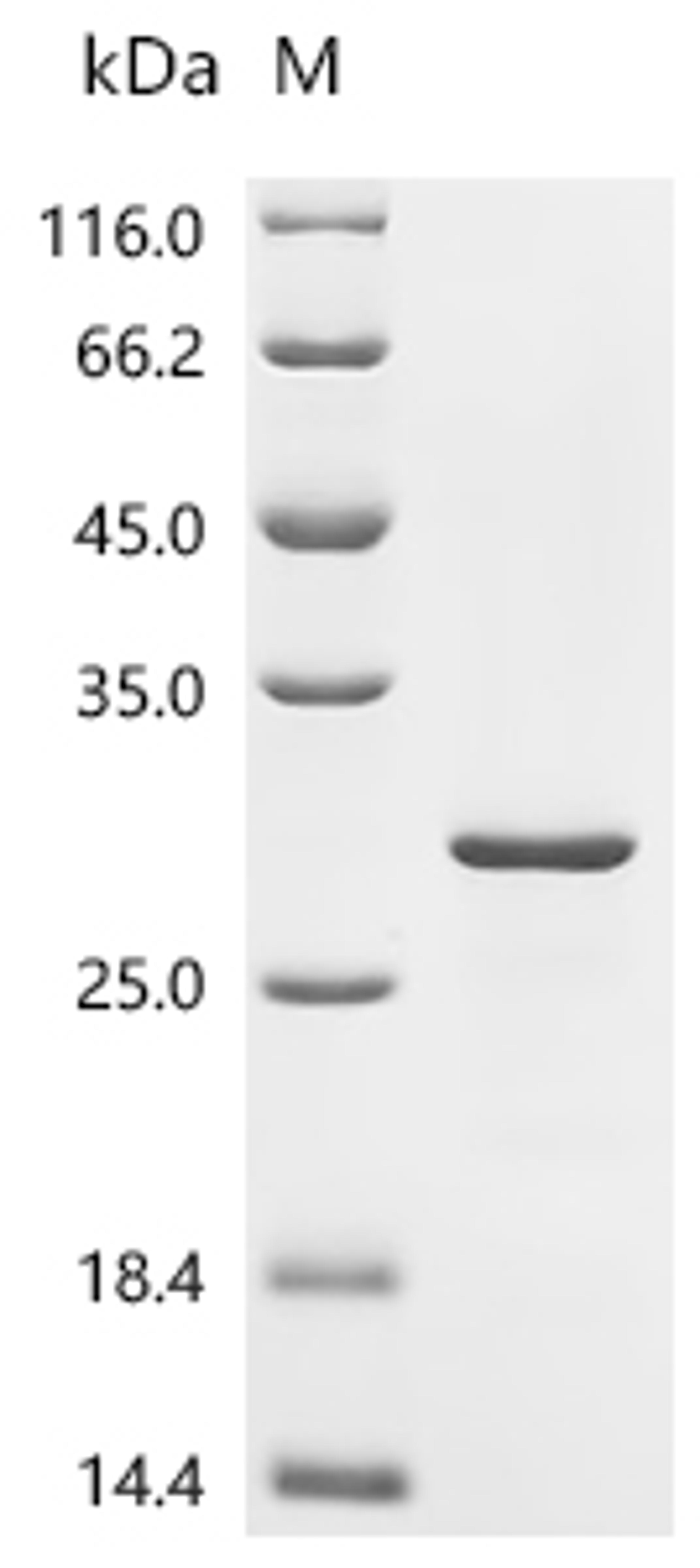 (Tris-Glycine gel) Discontinuous SDS-PAGE (reduced) with 5% enrichment gel and 15% separation gel.