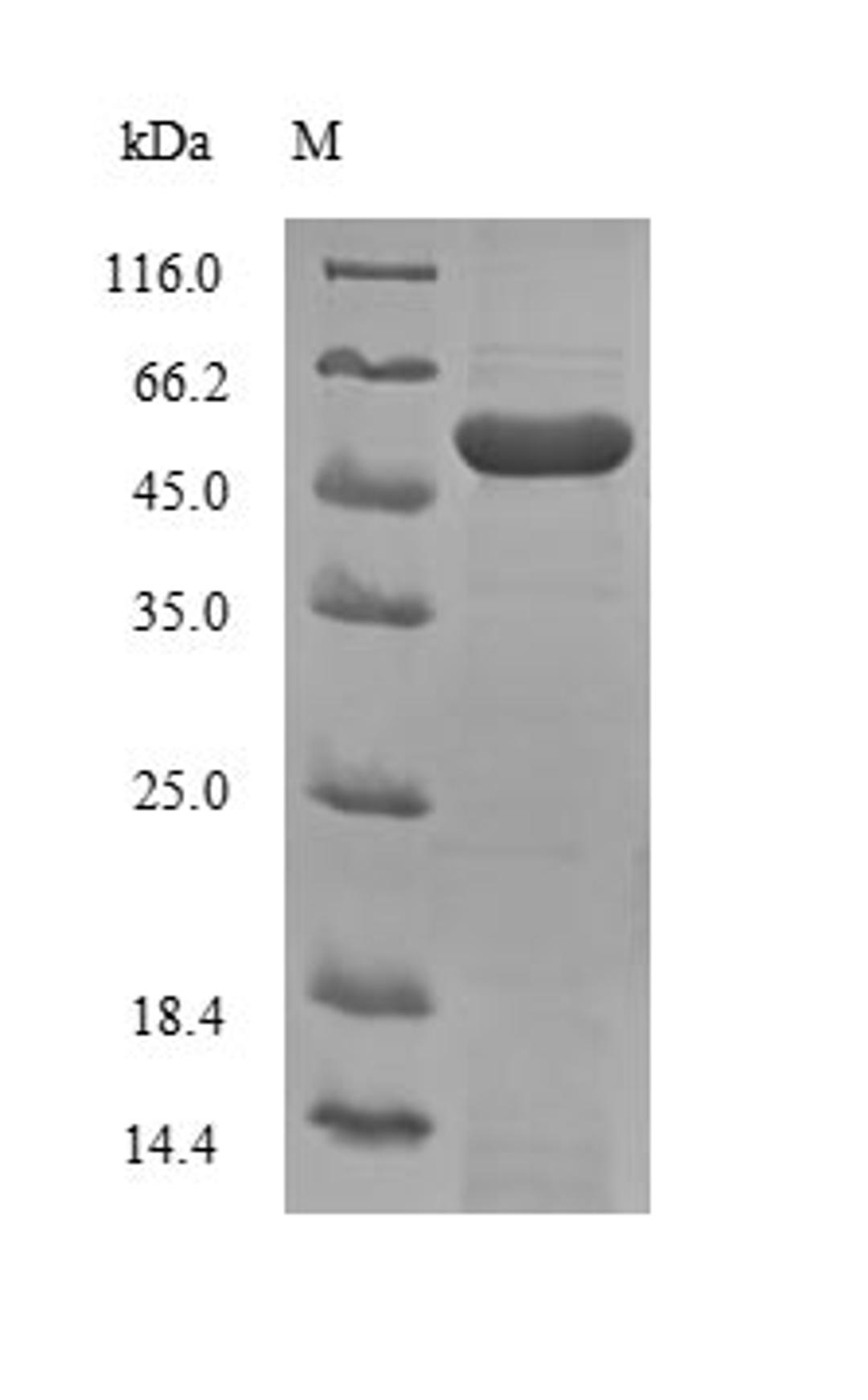 (Tris-Glycine gel) Discontinuous SDS-PAGE (reduced) with 5% enrichment gel and 15% separation gel.