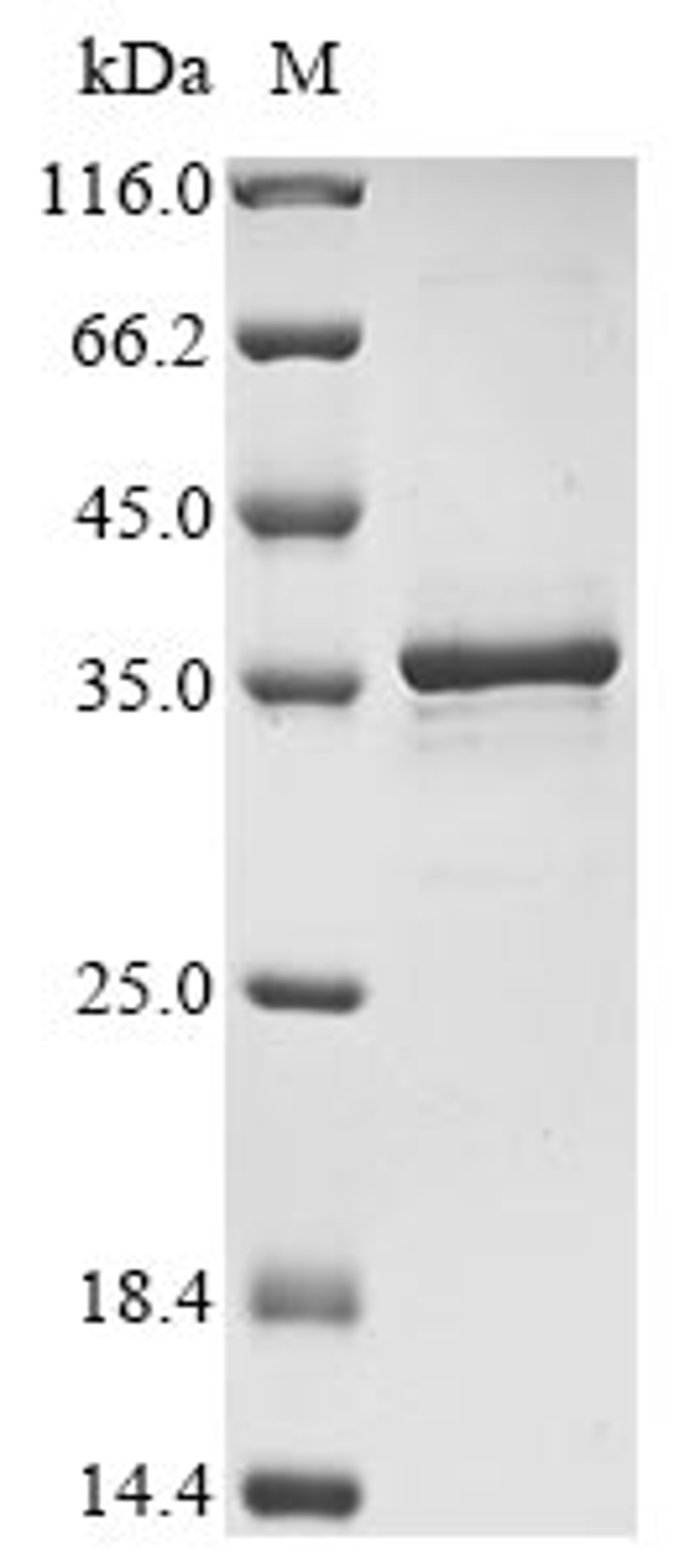 (Tris-Glycine gel) Discontinuous SDS-PAGE (reduced) with 5% enrichment gel and 15% separation gel.