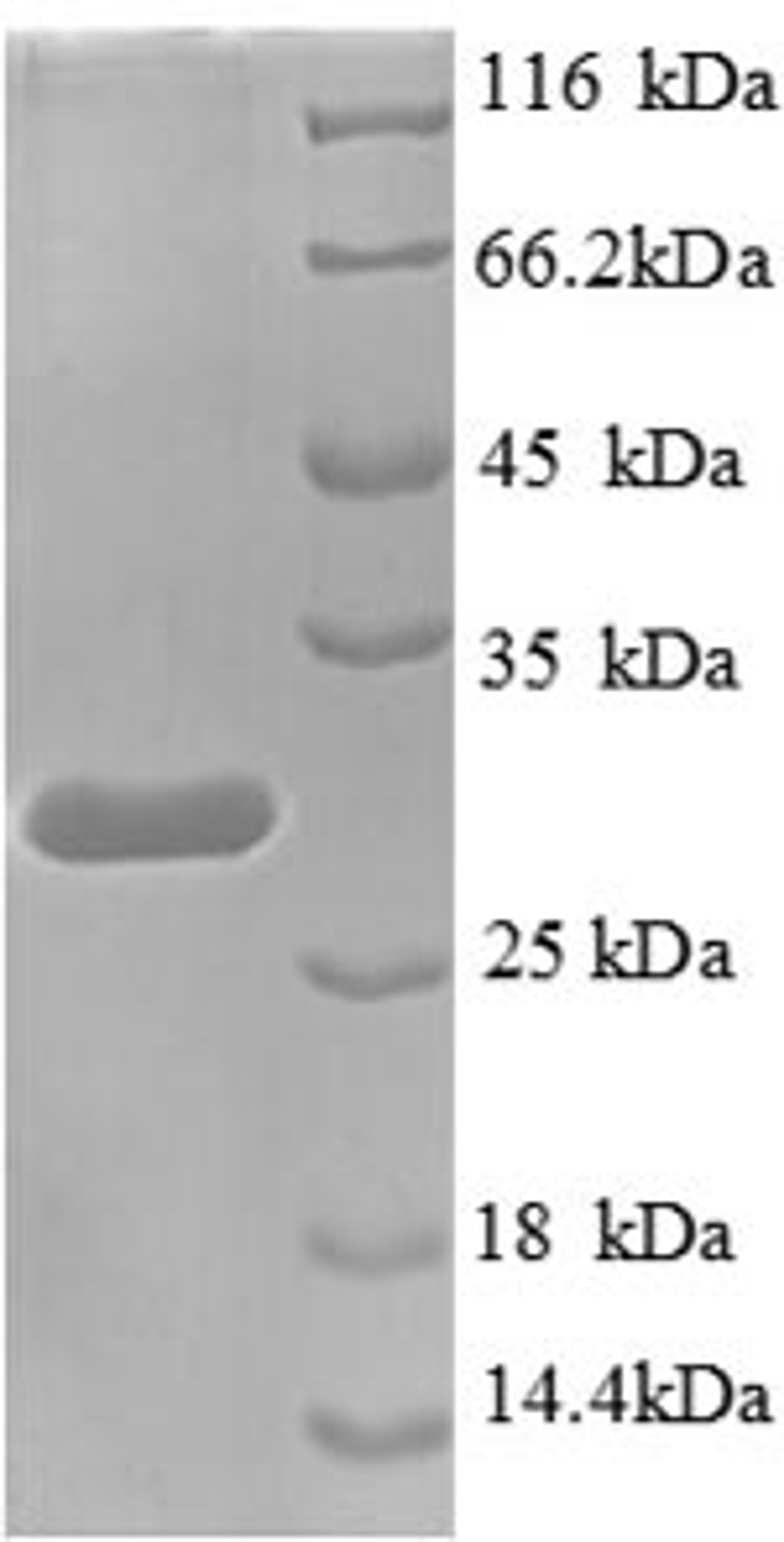 (Tris-Glycine gel) Discontinuous SDS-PAGE (reduced) with 5% enrichment gel and 15% separation gel.