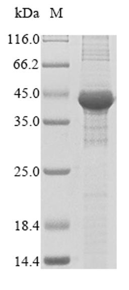 (Tris-Glycine gel) Discontinuous SDS-PAGE (reduced) with 5% enrichment gel and 15% separation gel.