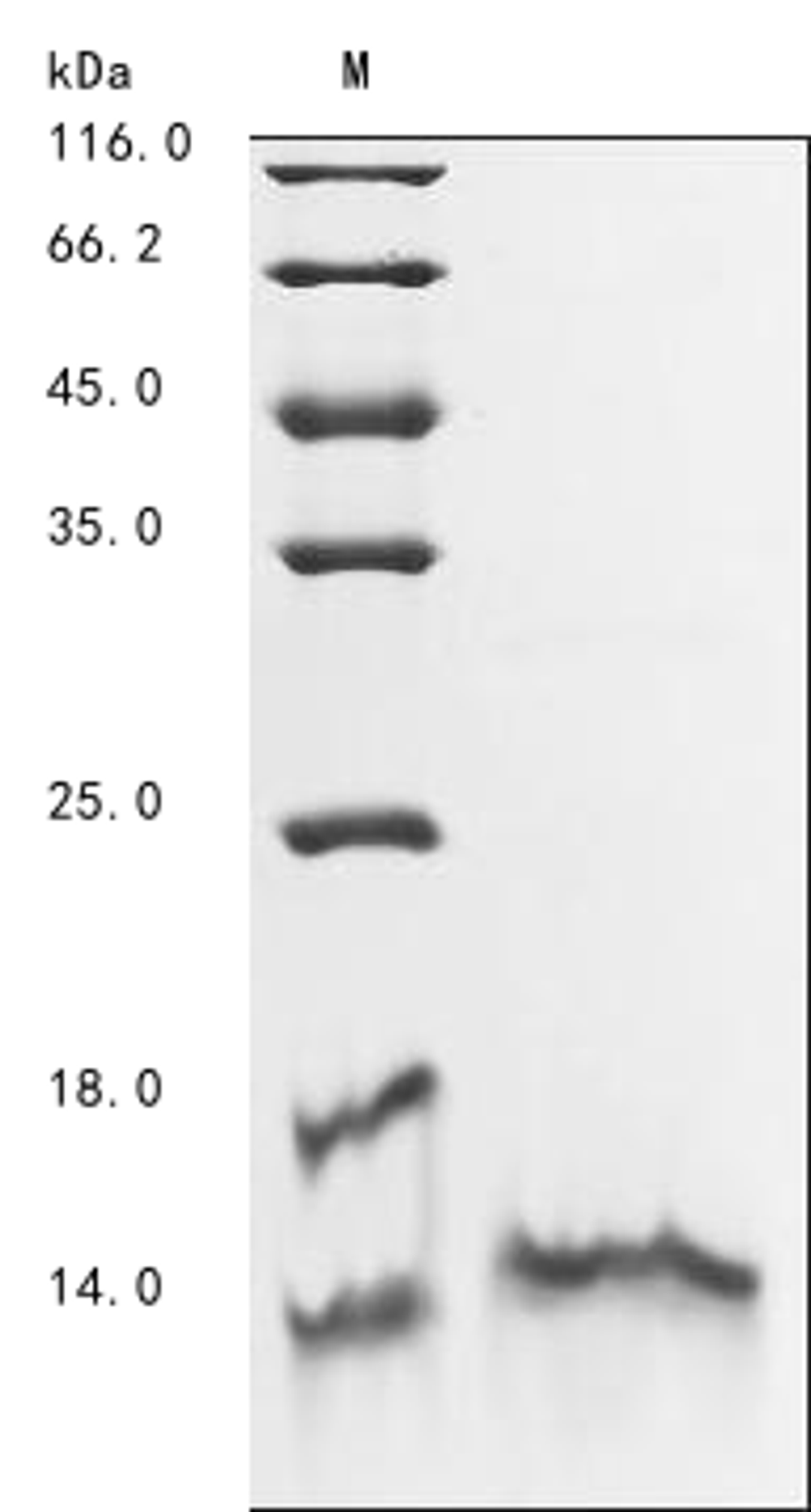 (Tris-Glycine gel) Discontinuous SDS-PAGE (reduced) with 5% enrichment gel and 15% separation gel.