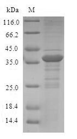 (Tris-Glycine gel) Discontinuous SDS-PAGE (reduced) with 5% enrichment gel and 15% separation gel.