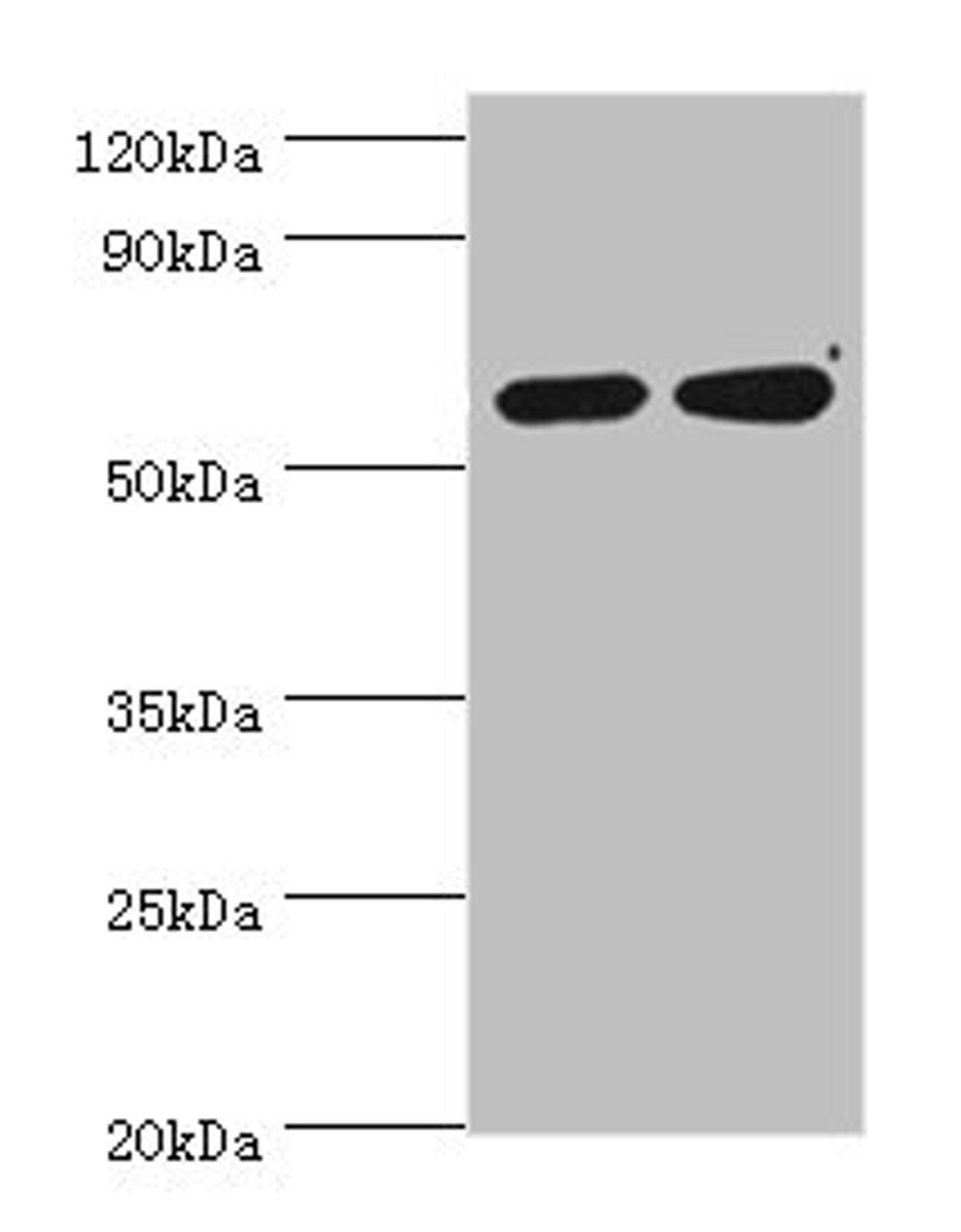 Western blot. All lanes: P4HA2 antibody at 6ug/ml. Lane 1: HepG2 whole cell lysate. Lane 2: 293T whole cell lysate. Secondary. Goat polyclonal to rabbit IgG at 1/10000 dilution. Predicted band size: 61 kDa. Observed band size: 61 kDa. 