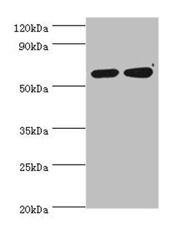 Western blot. All lanes: P4HA2 antibody at 6ug/ml. Lane 1: HepG2 whole cell lysate. Lane 2: 293T whole cell lysate. Secondary. Goat polyclonal to rabbit IgG at 1/10000 dilution. Predicted band size: 61 kDa. Observed band size: 61 kDa. 