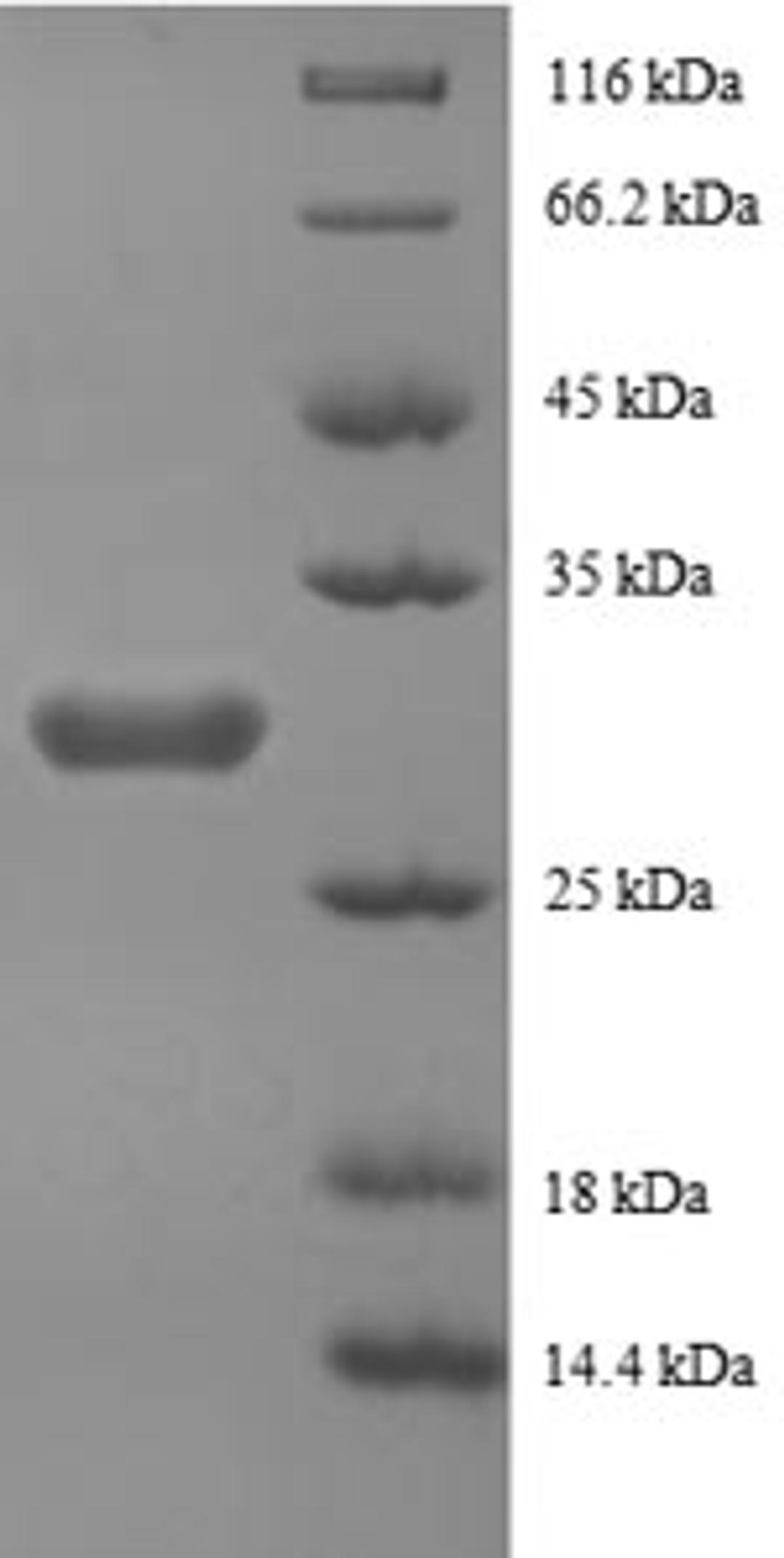 (Tris-Glycine gel) Discontinuous SDS-PAGE (reduced) with 5% enrichment gel and 15% separation gel.