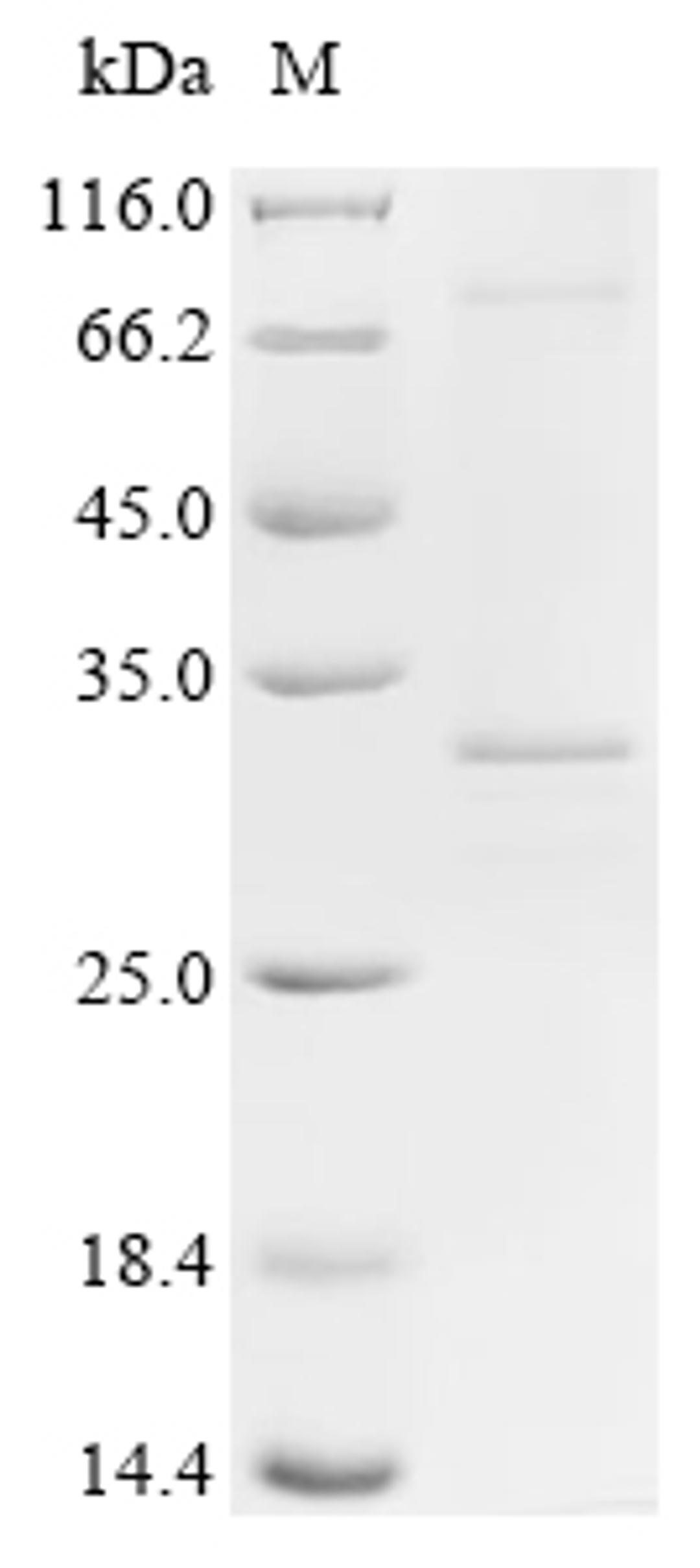 (Tris-Glycine gel) Discontinuous SDS-PAGE (reduced) with 5% enrichment gel and 15% separation gel.