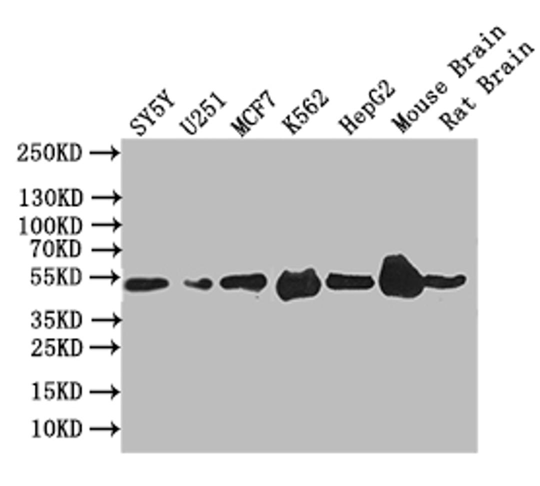 Western Blot. Positive WB detected in: SY5Y whole cell lysate,U251 whole cell lysate,MCF7 whole cell lysate,K562 whole cell lysate,Mouse Brain tissue lysate,Mouse Brain tissue lysate. All lanes: EGR2 antibody at 1:1000. Secondary. Goat polyclonal to rabbit IgG at 1/50000 dilution. Predicted band size: 50 kDa. Observed band size: 50 kDa. 