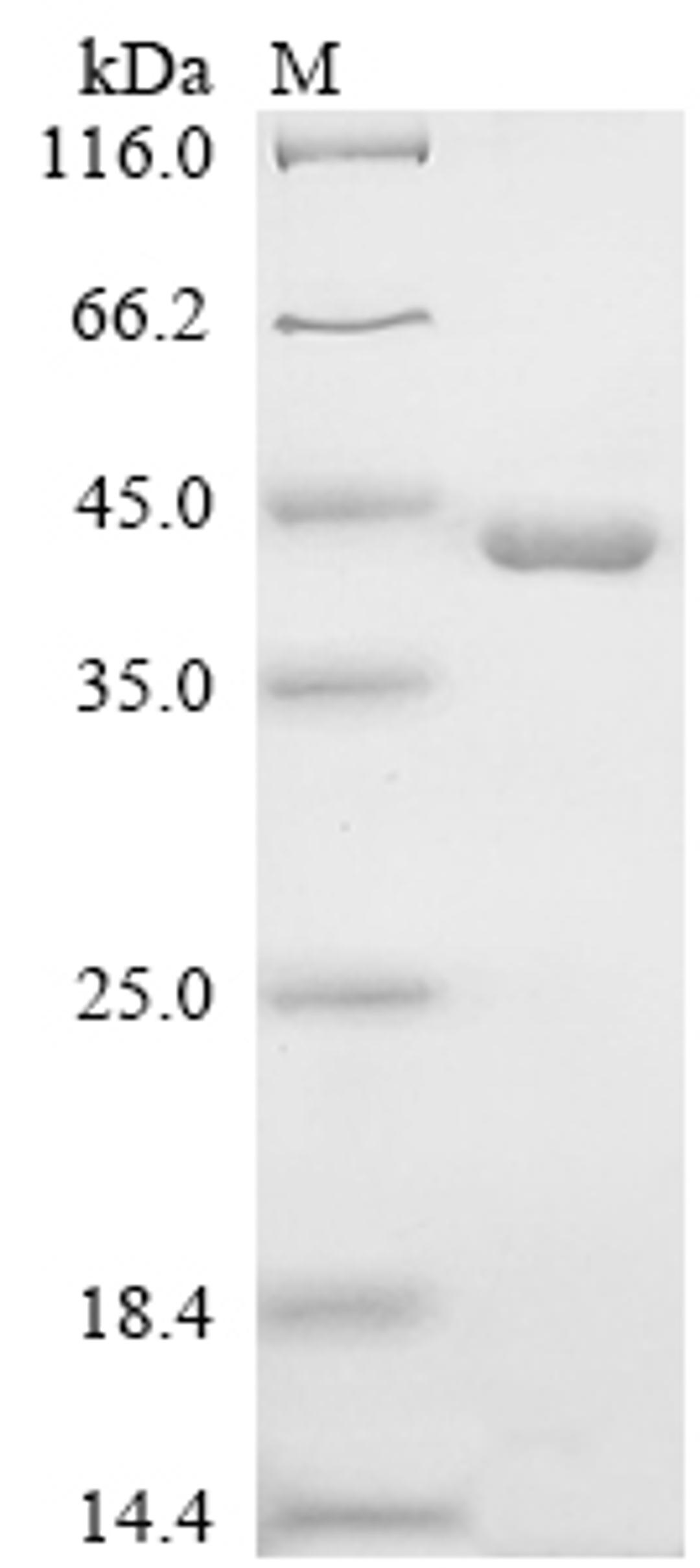 (Tris-Glycine gel) Discontinuous SDS-PAGE (reduced) with 5% enrichment gel and 15% separation gel.