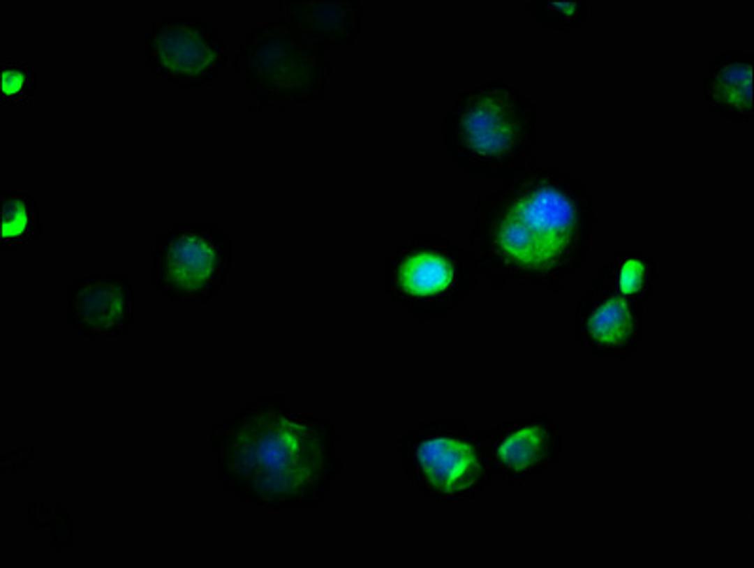 Immunofluorescence staining of MCF-7 cells with CSB-PA005835LA01HU at 1:133, counter-stained with DAPI. The cells were fixed in 4% formaldehyde, permeabilized using 0.2% Triton X-100 and blocked in 10% normal Goat Serum. The cells were then incubated with the antibody overnight at 4&deg;C. The secondary antibody was Alexa Fluor 488-congugated AffiniPure Goat Anti-Rabbit IgG(H+L).