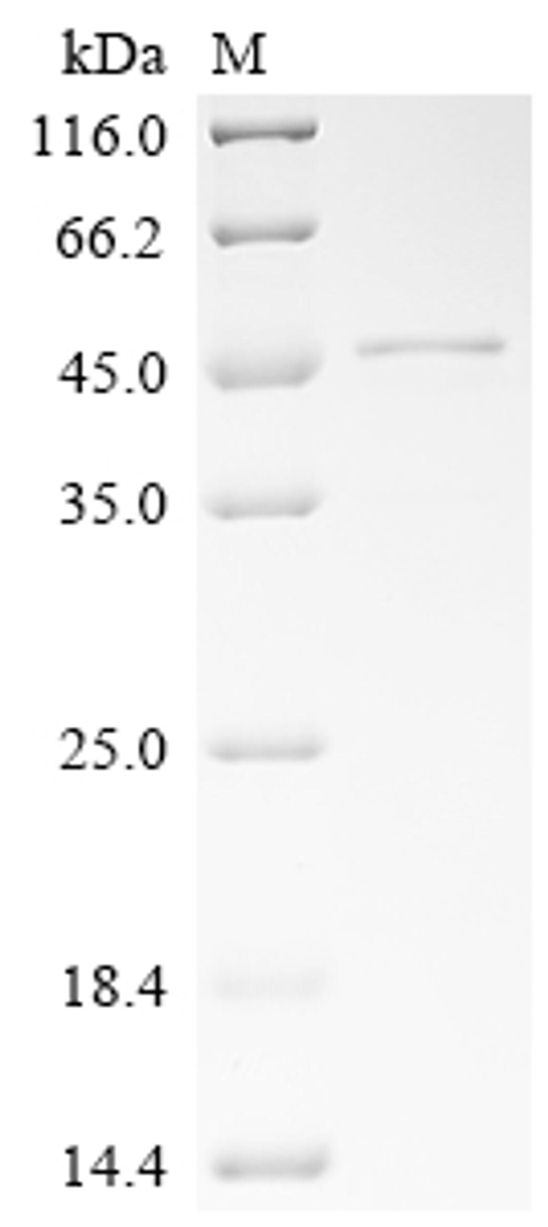 (Tris-Glycine gel) Discontinuous SDS-PAGE (reduced) with 5% enrichment gel and 15% separation gel.