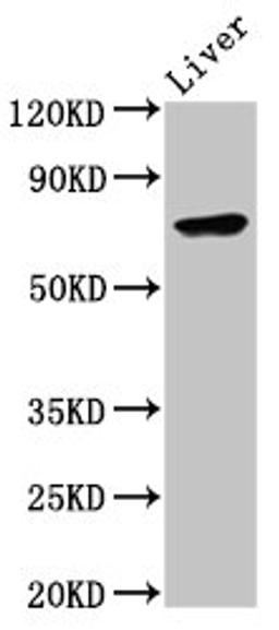 Western Blot. Positive WB detected in: Mouse liver tissue. All lanes: TNFAIP2 antibody at 6.9ug/ml. Secondary. Goat polyclonal to rabbit IgG at 1/50000 dilution. Predicted band size: 73 kDa. Observed band size: 73 kDa. 