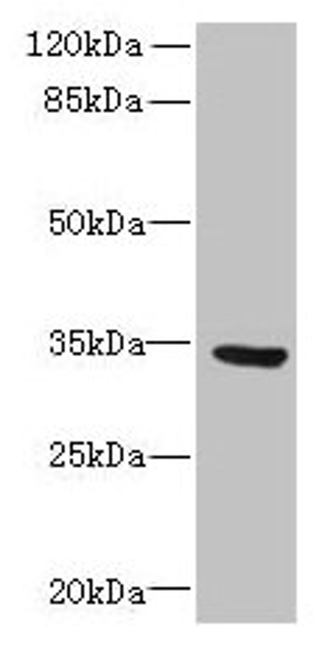 Western blot. All lanes: SLC25A18 antibody at 0.3ug/ml + U87 whole cell lysate. Secondary. Goat polyclonal to rabbit IgG at 1/10000 dilution. Predicted band size: 34 kDa. Observed band size: 34 kDa. 