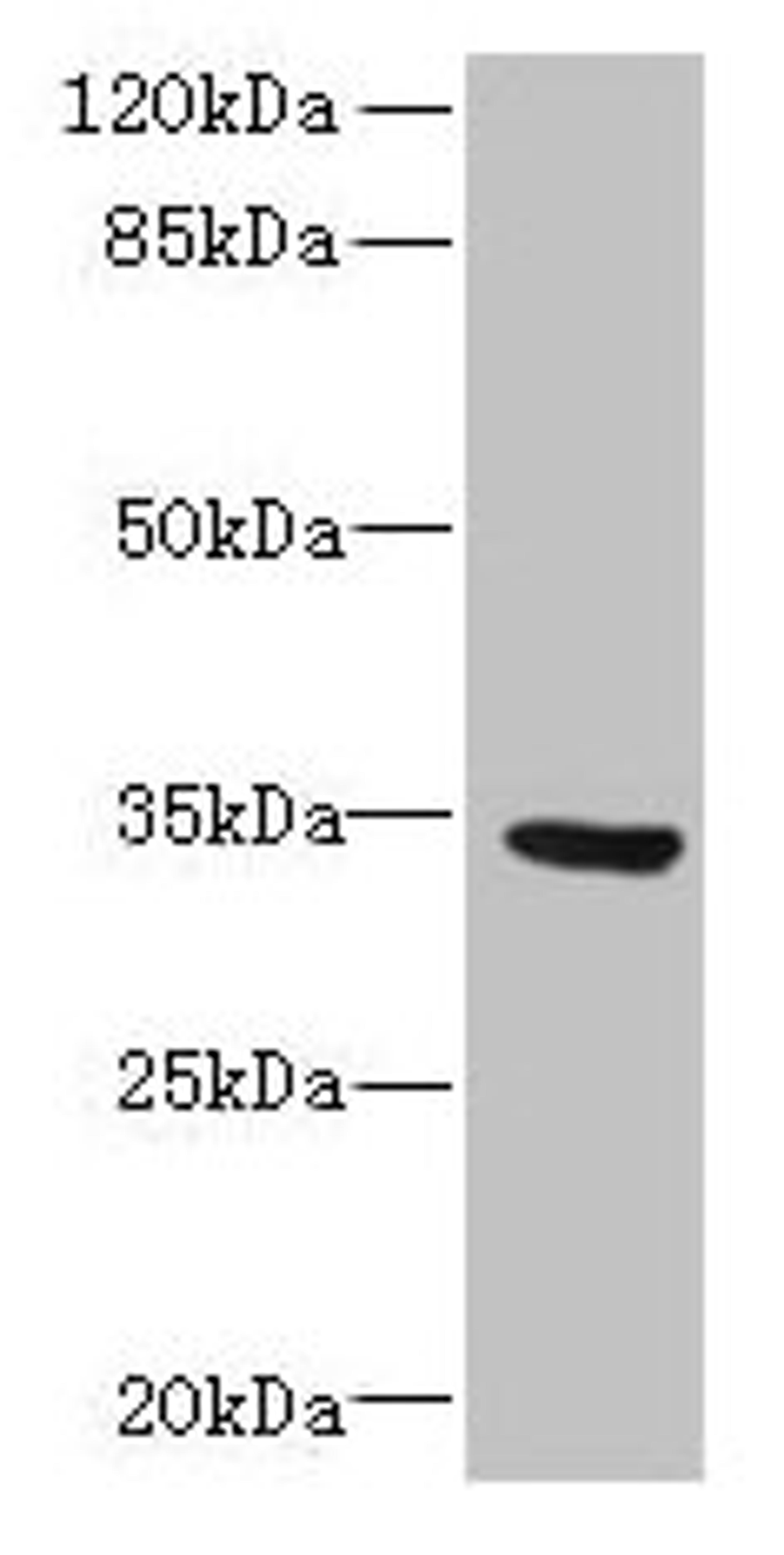 Western blot. All lanes: SLC25A18 antibody at 0.3ug/ml + U87 whole cell lysate. Secondary. Goat polyclonal to rabbit IgG at 1/10000 dilution. Predicted band size: 34 kDa. Observed band size: 34 kDa. 