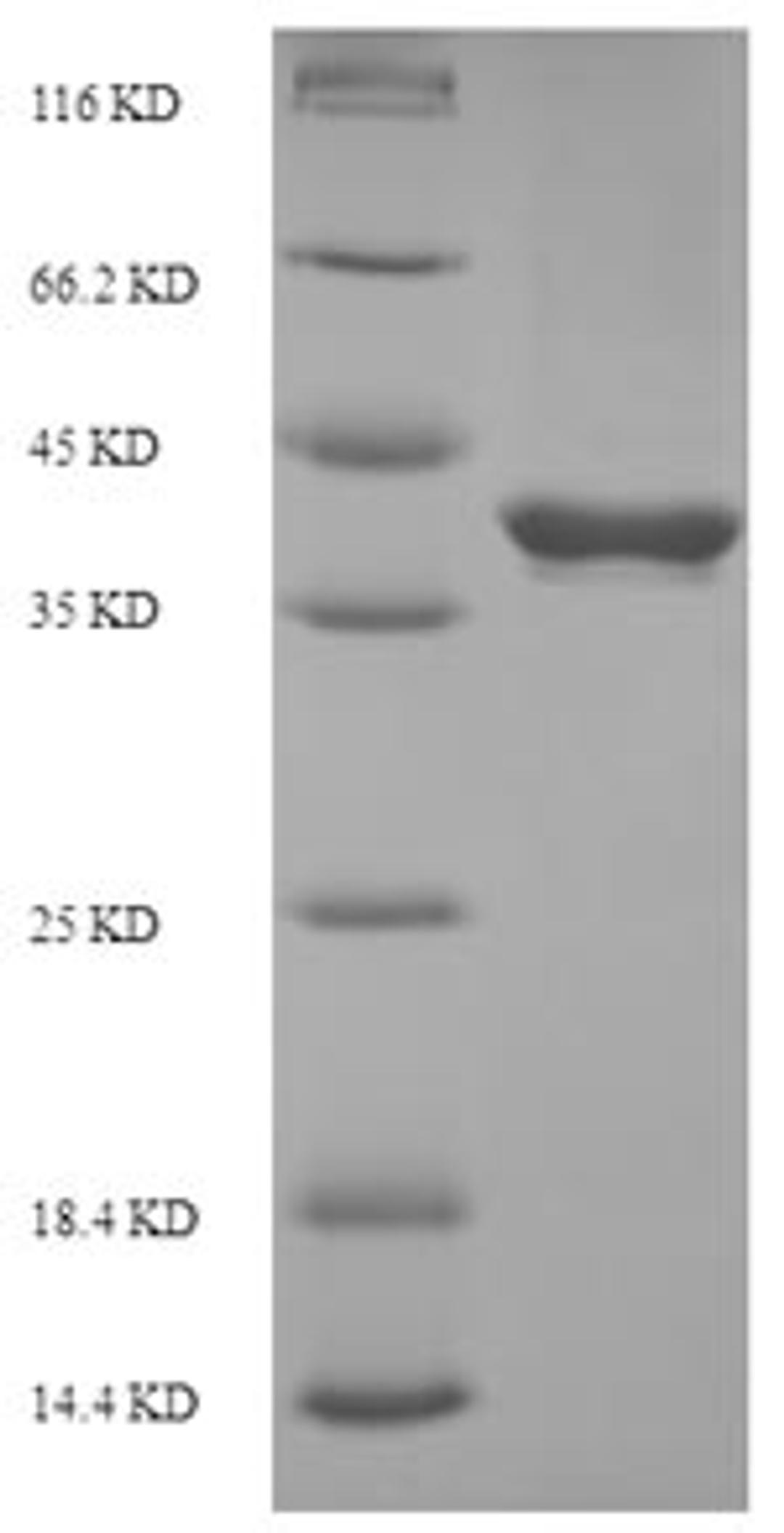 (Tris-Glycine gel) Discontinuous SDS-PAGE (reduced) with 5% enrichment gel and 15% separation gel.