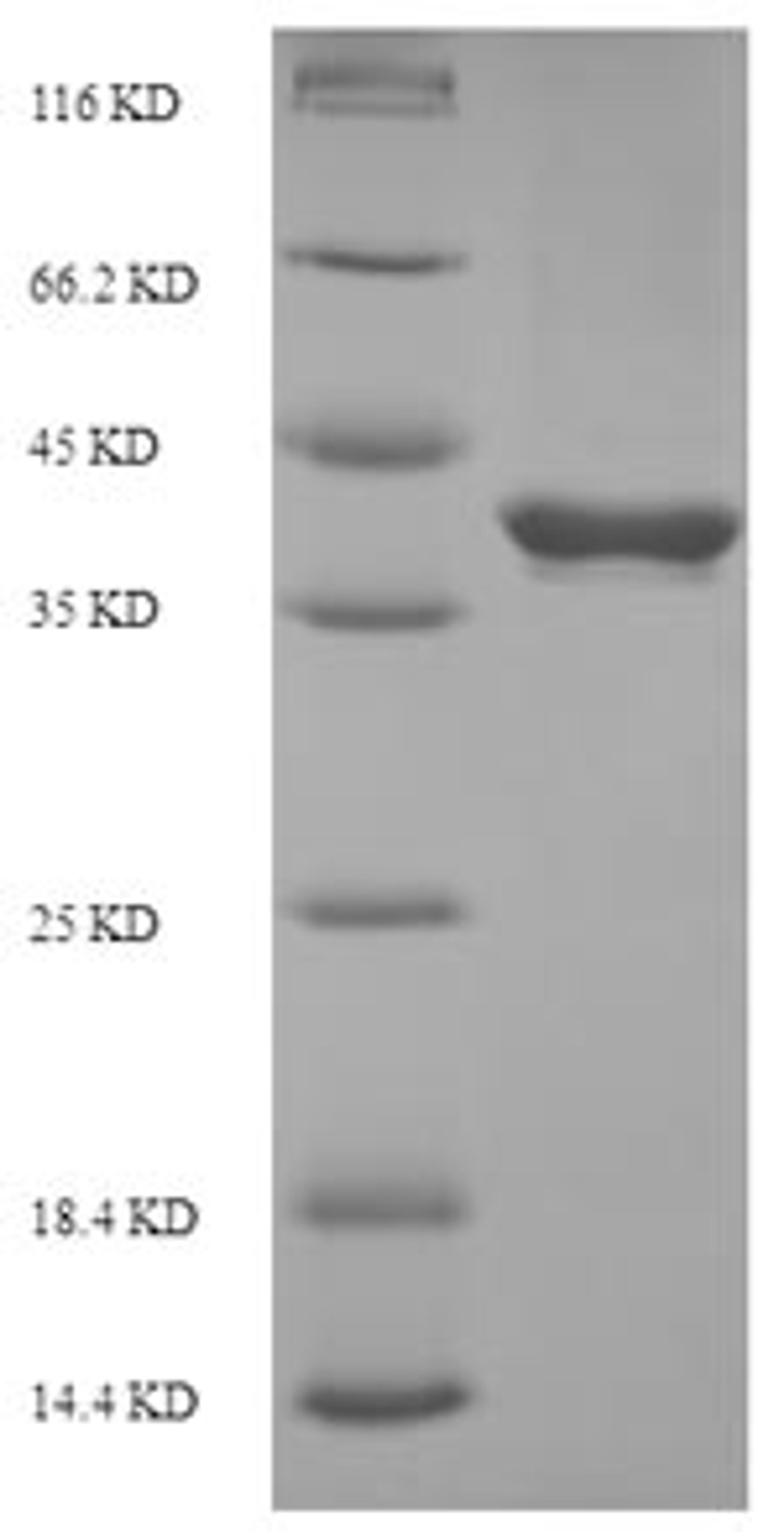 (Tris-Glycine gel) Discontinuous SDS-PAGE (reduced) with 5% enrichment gel and 15% separation gel.