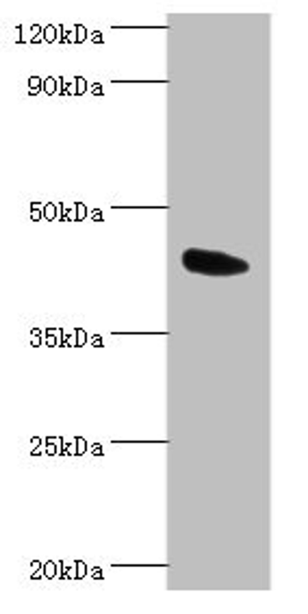 Western blot. All lanes: Angiopoietin-related protein 4 antibody at 2ug/ml + Mouse heart tissue. Secondary. Goat polyclonal to rabbit IgG at 1/10000 dilution. Predicted band size: 46, 41, 27 kDa. Observed band size: 46 kDa. 