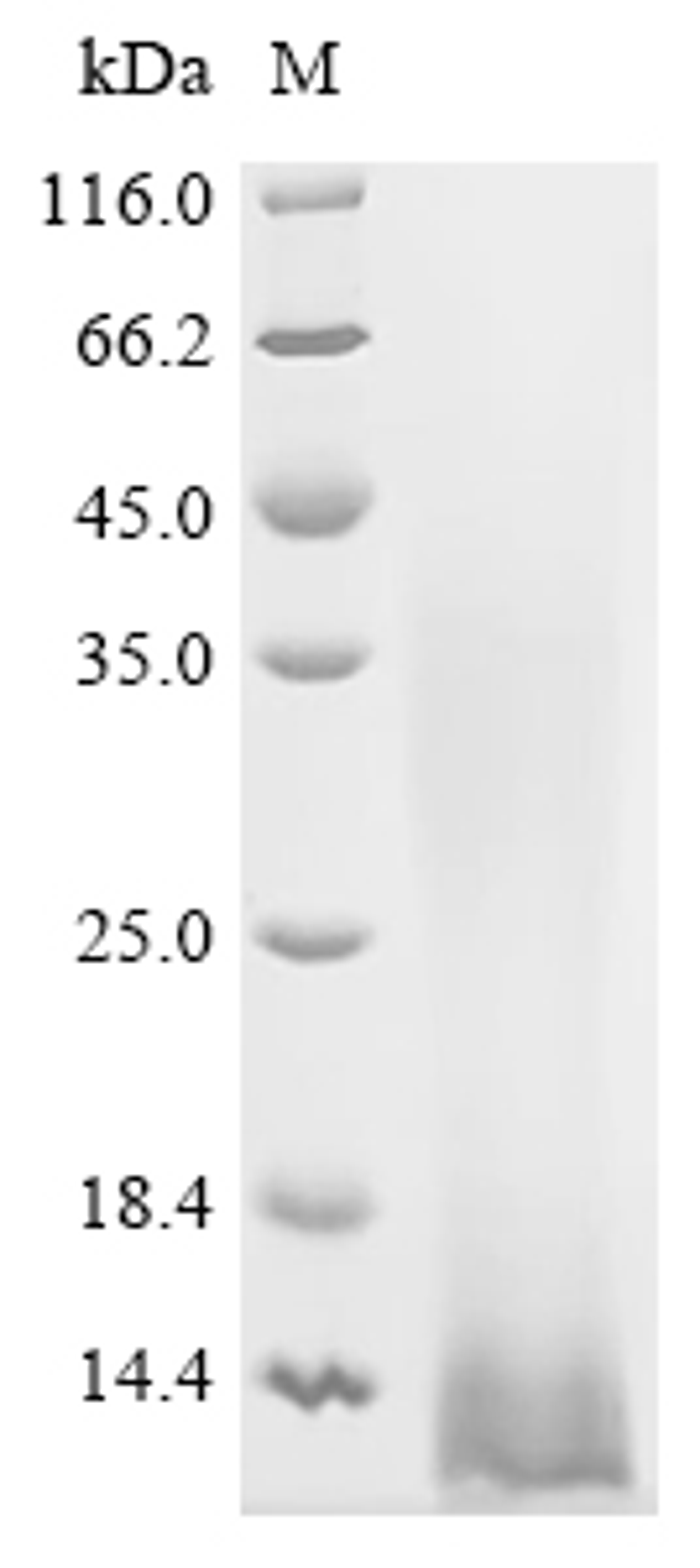 (Tris-Glycine gel) Discontinuous SDS-PAGE (reduced) with 5% enrichment gel and 15% separation gel.