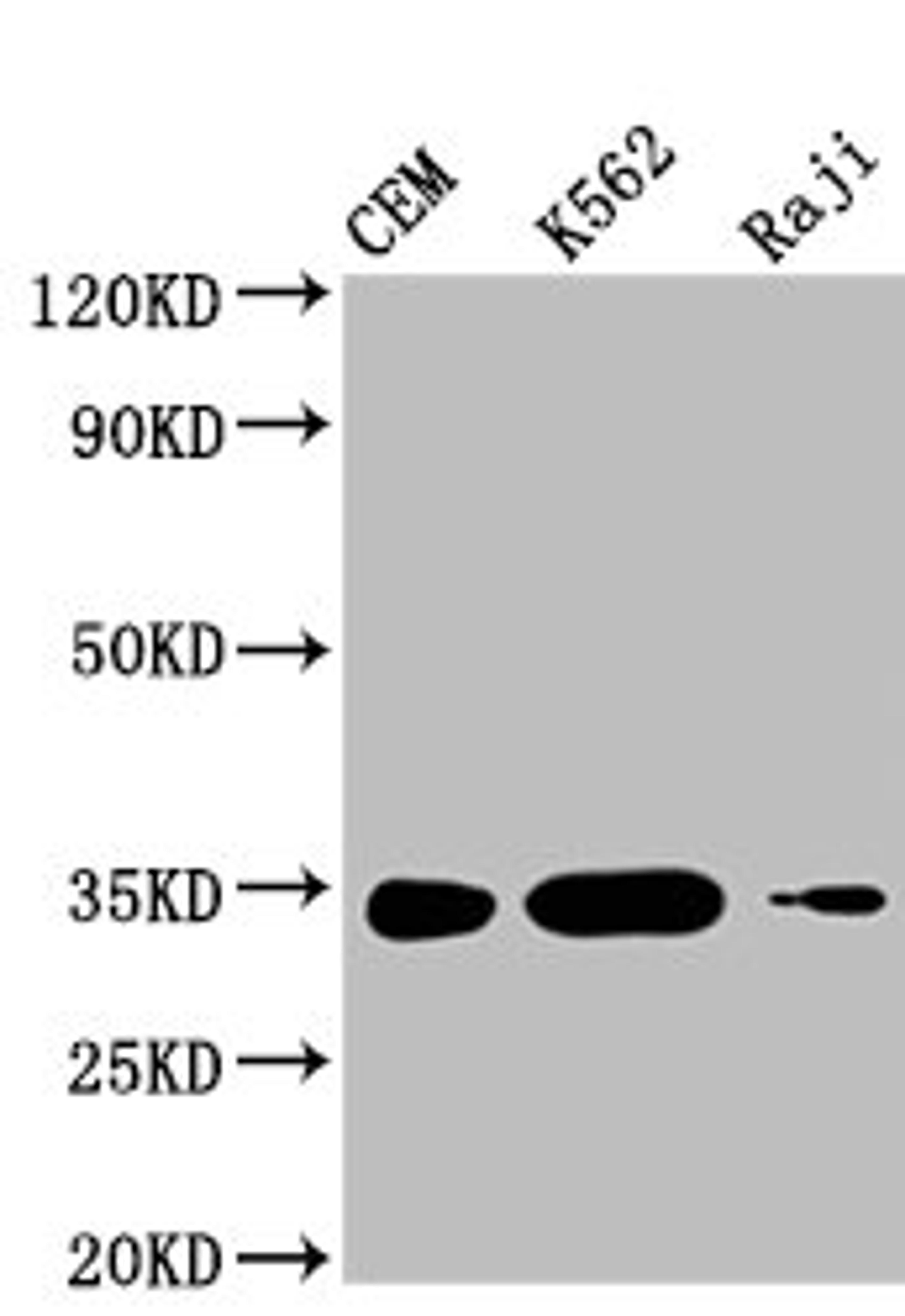 Western Blot. Positive WB detected in: CEM whole cell lysate, K562 whole cell lysate, Raji whole cell lysate . All lanes: CTLA4 antibody at 1:1000. Secondary. Goat polyclonal to mouse IgG at 1/50000 dilution. Predicted band size: 25, 7, 9, 20 KDa. Observed band size: 34 KDa. Exposure time：5min
