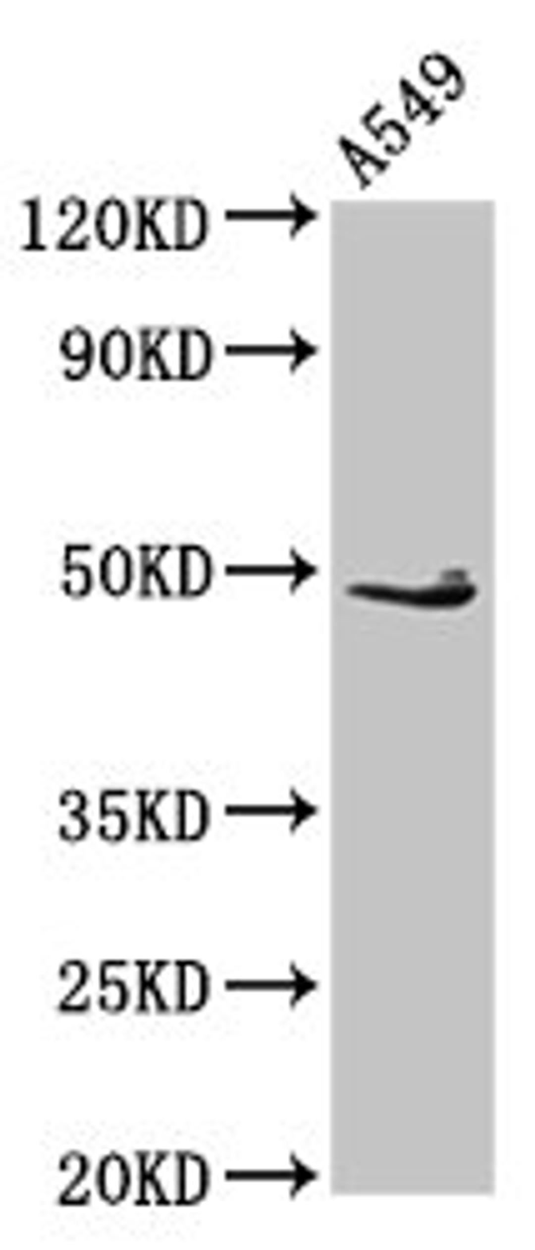Western Blot. Positive WB detected in: A549 whole cell lysate. All lanes: EDAR antibody at 2.7µg/ml. Secondary. Goat polyclonal to rabbit IgG at 1/50000 dilution. Predicted band size: 49, 52 kDa. Observed band size: 49 kDa