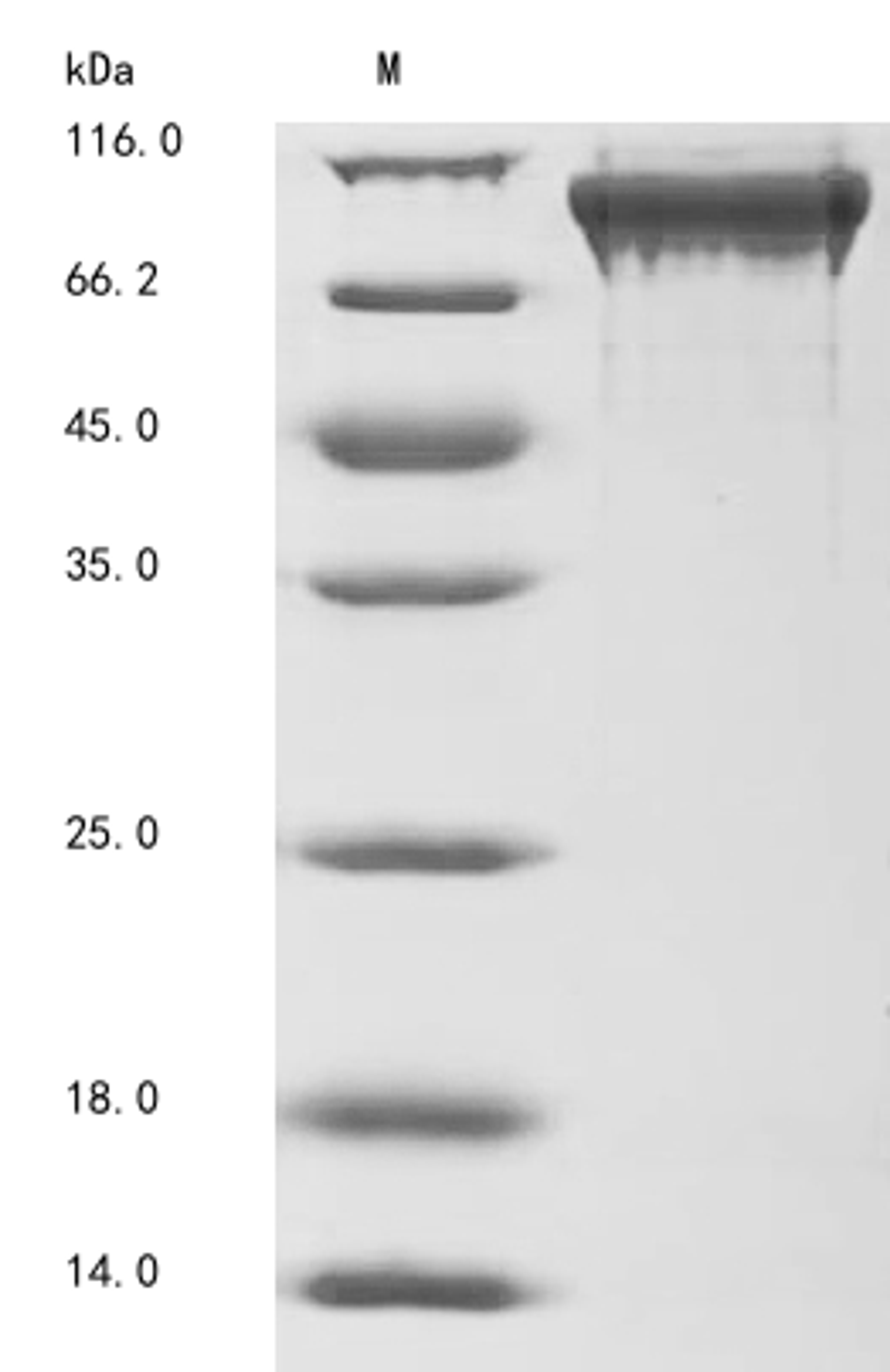 (Tris-Glycine gel) Discontinuous SDS-PAGE (reduced) with 5% enrichment gel and 15% separation gel.