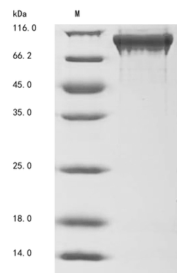 (Tris-Glycine gel) Discontinuous SDS-PAGE (reduced) with 5% enrichment gel and 15% separation gel.
