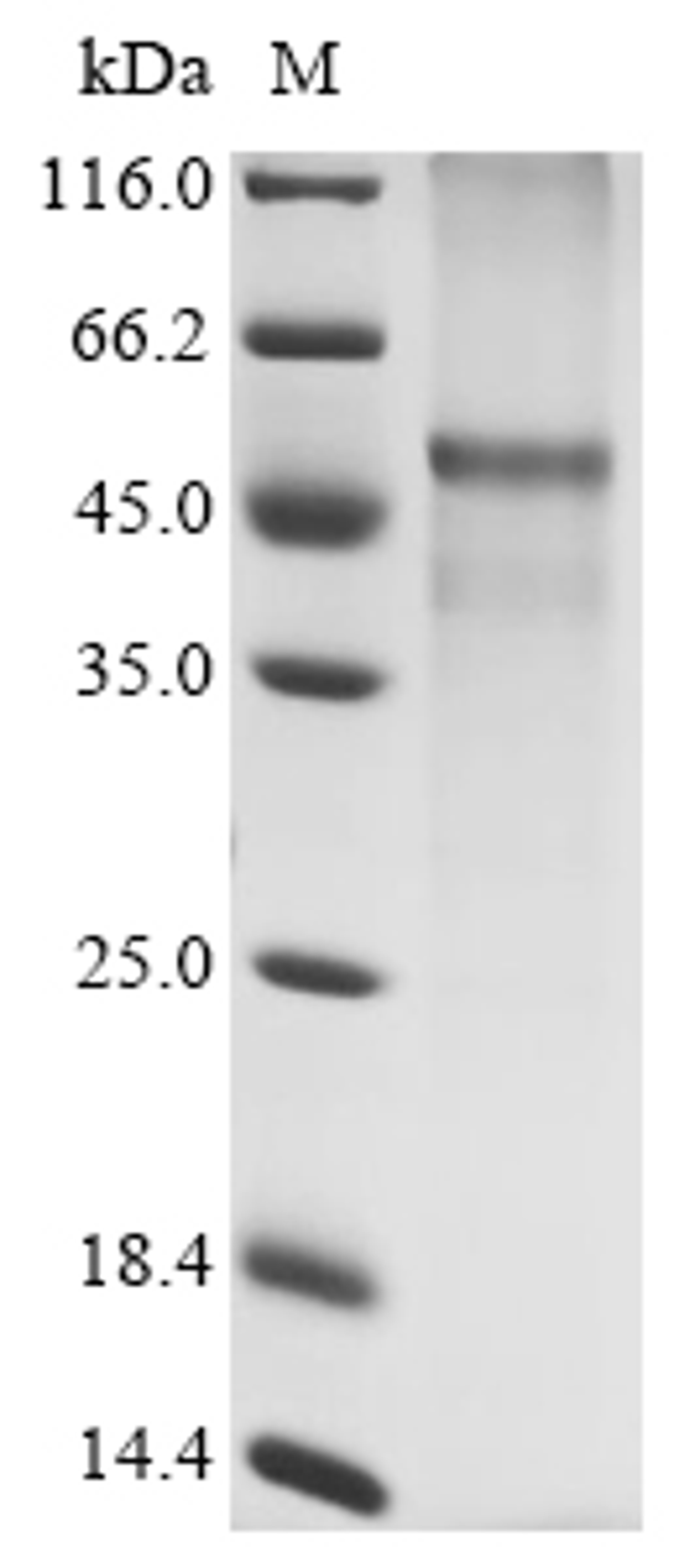 (Tris-Glycine gel) Discontinuous SDS-PAGE (reduced) with 5% enrichment gel and 15% separation gel.
