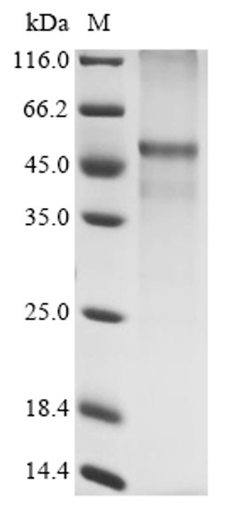 (Tris-Glycine gel) Discontinuous SDS-PAGE (reduced) with 5% enrichment gel and 15% separation gel.