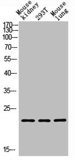 Western blot analysis of Mouse kidney, 293T, Mouse lung, antibody was diluted at 1000. Secondary antibody  was diluted at 1:20000