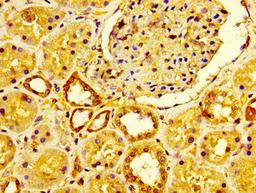 IHC image of CSB-PA009078LA01HU diluted at 1:600 and staining in paraffin-embedded human kidney tissue performed on a Leica BondTM system. After dewaxing and hydration, antigen retrieval was mediated by high pressure in a citrate buffer (pH 6.0). Section was blocked with 10% normal goat serum 30min at RT. Then primary antibody (1% BSA) was incubated at 4&deg;C overnight. The primary is detected by a biotinylated secondary antibody and visualized using an HRP conjugated SP system.