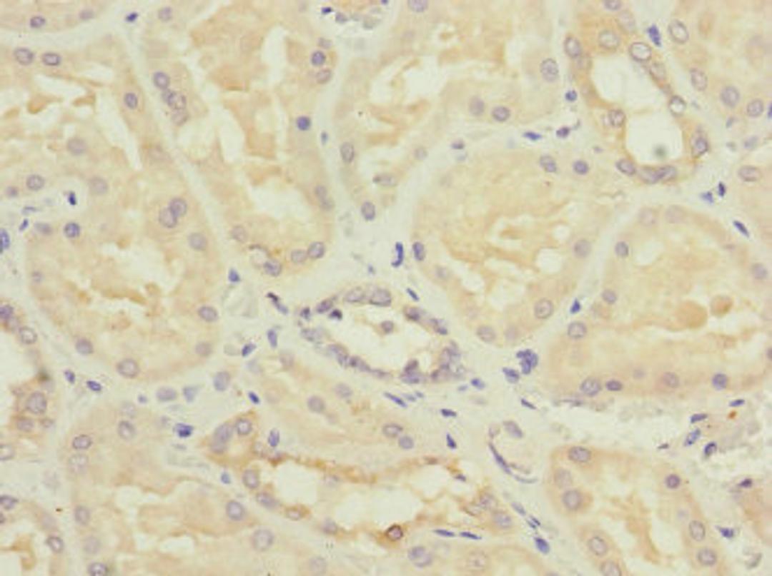 Immunohistochemistry of paraffin-embedded human kidney tissue using CSB-PA614400ESR2HU at dilution of 1:100