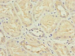 Immunohistochemistry of paraffin-embedded human kidney tissue using CSB-PA614400ESR2HU at dilution of 1:100
