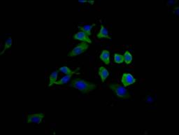 Immunofluorescence staining of HepG2 Cells with CSB-RA592348A0HU at 1:50, counter-stained with DAPI. The cells were fixed in 4% formaldehyde, permeated by 0.2% TritonX-100, and blocked in 10% normal Goat Serum. The cells were then incubated with the antibody overnight at 4℃. Nuclear DNA was labeled in blue with DAPI. The secondary antibody was FITC-conjugated AffiniPure Goat Anti-Rabbit IgG (H+L).