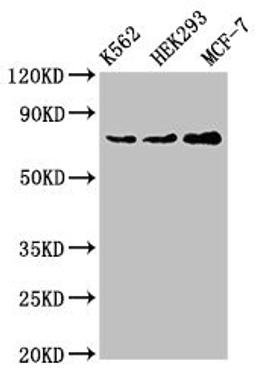 Western Blot. Positive WB detected in: K562 whole cell lysate, HEK293 whole cell lysate, MCF-7 whole cell lysate. All lanes: RALBP1 antibody at 4ug/ml. Secondary. Goat polyclonal to rabbit IgG at 1/50000 dilution. Predicted band size: 77 kDa. Observed band size: 77 kDa. 