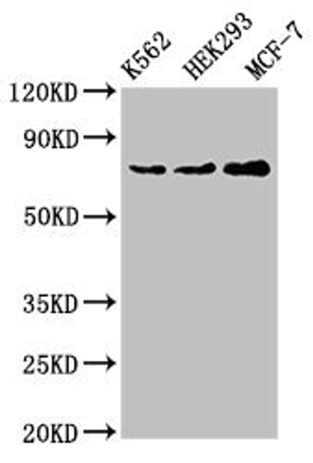 Western Blot. Positive WB detected in: K562 whole cell lysate, HEK293 whole cell lysate, MCF-7 whole cell lysate. All lanes: RALBP1 antibody at 4ug/ml. Secondary. Goat polyclonal to rabbit IgG at 1/50000 dilution. Predicted band size: 77 kDa. Observed band size: 77 kDa.