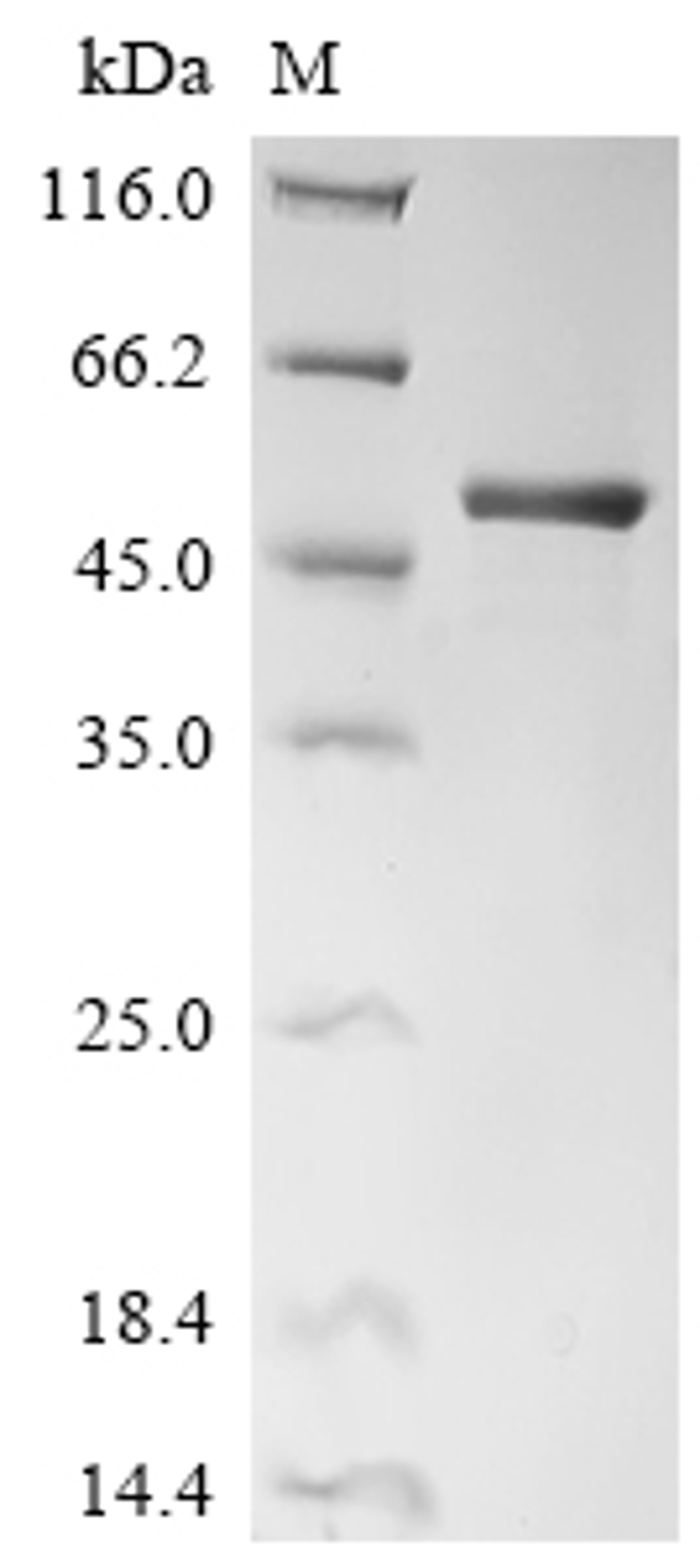 (Tris-Glycine gel) Discontinuous SDS-PAGE (reduced) with 5% enrichment gel and 15% separation gel.