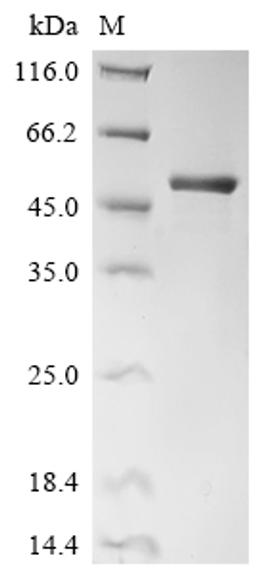 (Tris-Glycine gel) Discontinuous SDS-PAGE (reduced) with 5% enrichment gel and 15% separation gel.