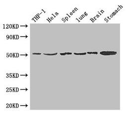 Western Blot. Positive WB detected in: THP-1 whole cell lysate, Hela whole cell lysate, Mouse spleen tissue, Mouse lung tissue, Mouse brain tissue, Mouse stomach tissue. All lanes: MSR1 antibody at 1.5ug/ml. Secondary. Goat polyclonal to rabbit IgG at 1/50000 dilution. Predicted band size: 50, 40, 43 kDa. Observed band size: 50 kDa. 